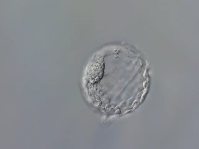 A blastocyst micrograph showing the internal cell cluster and cavity