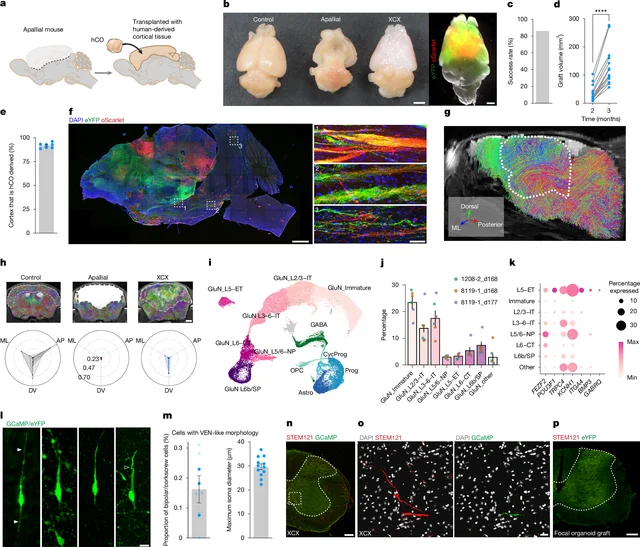 이종피질화 원본 Figure 2. 대조군·피질 감소 숙주·인간 오가노이드 이식군의 뇌와 MRI, 세포 유형 및 장거리 투사 경로.